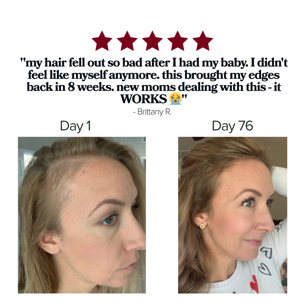 Edge Crisis Rescue Stick™ - For Thinning, Broken, Disappearing Edges.