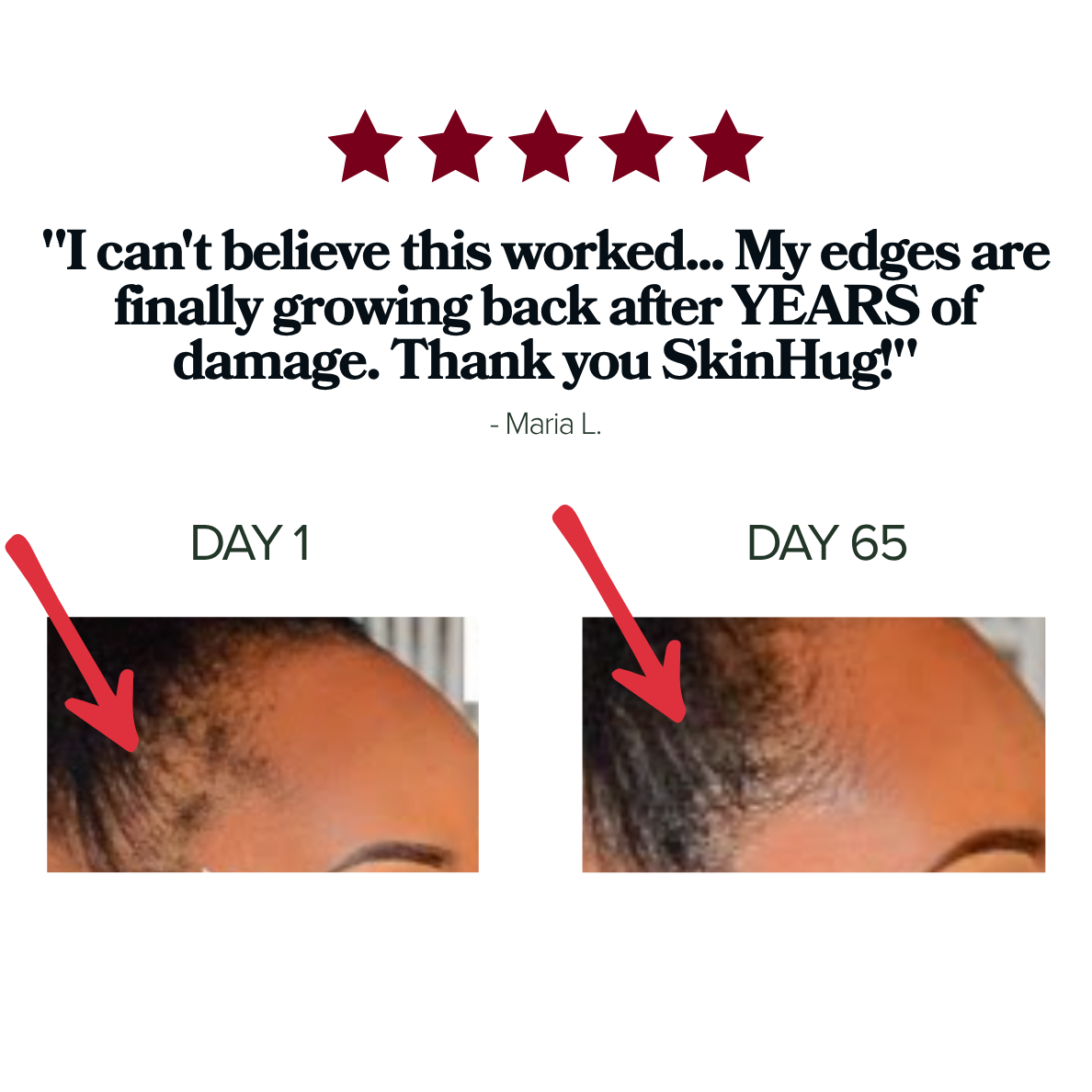 Edge Crisis Rescue Stick™ - For Thinning, Broken, Disappearing Edges.