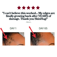 Edge Crisis Rescue Stick™ - For Thinning, Broken, Disappearing Edges.