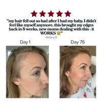 Edge Crisis Rescue Stick™ - For Thinning, Broken, Disappearing Edges.