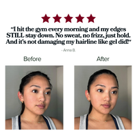 Edge Crisis Rescue Stick™ - For Thinning, Broken, Disappearing Edges.